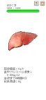 Screenshot 1: My Baby Liver 